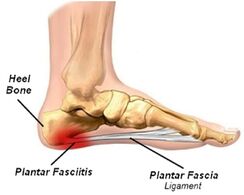 constant pain in heel